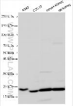 RNF5 Antibody in Western Blot (WB)