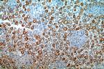 FAM96B Antibody in Immunohistochemistry (Paraffin) (IHC (P))