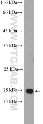FAM96B Antibody in Western Blot (WB)