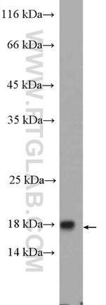 FAM96B Antibody in Western Blot (WB)