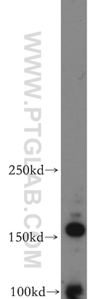 ARHGEF40 Antibody in Western Blot (WB)