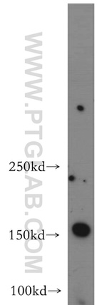 ARHGEF40 Antibody in Western Blot (WB)