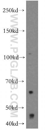 OVCA1 Antibody in Western Blot (WB)