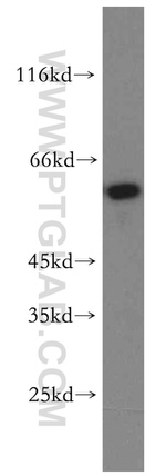 NOSTRIN Antibody in Western Blot (WB)