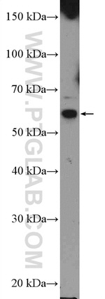 NOSTRIN Antibody in Western Blot (WB)