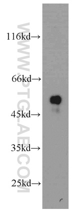 TMCO6 Antibody in Western Blot (WB)