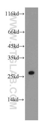 APOBEC2 Antibody in Western Blot (WB)