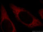 CUEDC2 Antibody in Immunocytochemistry (ICC/IF)