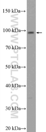C15orf39 Antibody in Western Blot (WB)