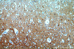 FAM49B Antibody in Immunohistochemistry (Paraffin) (IHC (P))
