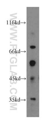 FAM49B Antibody in Western Blot (WB)