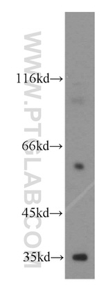 FAM49B Antibody in Western Blot (WB)