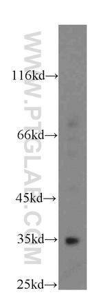 FAM49B Antibody in Western Blot (WB)