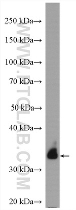 FAM49B Antibody in Western Blot (WB)