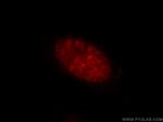 KCTD15 Antibody in Immunocytochemistry (ICC/IF)