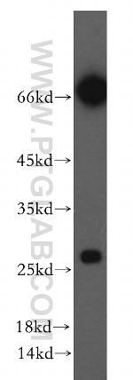 KCTD15 Antibody in Western Blot (WB)