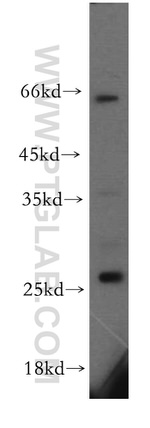 KCTD15 Antibody in Western Blot (WB)