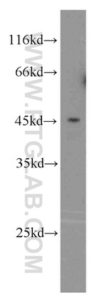 GTPBP5 Antibody in Western Blot (WB)