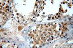 GTPBP5 Antibody in Immunohistochemistry (Paraffin) (IHC (P))