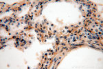ACAP1 Antibody in Immunohistochemistry (Paraffin) (IHC (P))