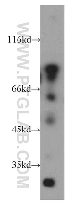 ACAP1 Antibody in Western Blot (WB)