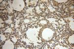 ACAP1 Antibody in Immunohistochemistry (Paraffin) (IHC (P))