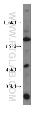 ACAP1 Antibody in Western Blot (WB)