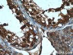 CXorf26 Antibody in Immunohistochemistry (Paraffin) (IHC (P))