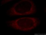 EXD2 Antibody in Immunocytochemistry (ICC/IF)