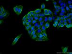 MCT1 Antibody in Immunocytochemistry (ICC/IF)