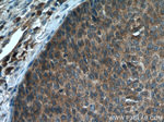 MCT1 Antibody in Immunohistochemistry (Paraffin) (IHC (P))