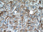MCT1 Antibody in Immunohistochemistry (Paraffin) (IHC (P))