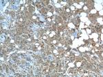 MCT1 Antibody in Immunohistochemistry (Paraffin) (IHC (P))