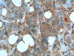 MCT1 Antibody in Immunohistochemistry (Paraffin) (IHC (P))