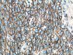 MCT1 Antibody in Immunohistochemistry (Paraffin) (IHC (P))