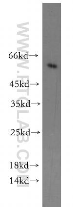 CYP4Z1 Antibody in Western Blot (WB)