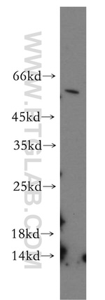 CYP4Z1 Antibody in Western Blot (WB)