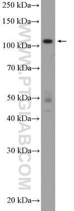HNRNPUL2 Antibody in Western Blot (WB)