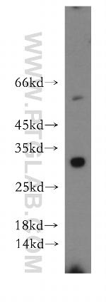BIRC8 Antibody in Western Blot (WB)
