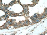 SHP2 Antibody in Immunohistochemistry (Paraffin) (IHC (P))