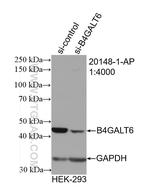 B4GALT6 Antibody in Western Blot (WB)