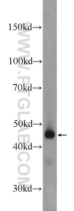 B4GALT6 Antibody in Western Blot (WB)