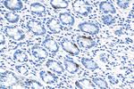 LGR4 Antibody in Immunohistochemistry (Paraffin) (IHC (P))