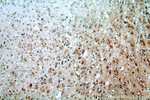 RDM1 Antibody in Immunohistochemistry (Paraffin) (IHC (P))