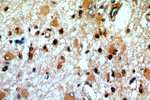RDM1 Antibody in Immunohistochemistry (Paraffin) (IHC (P))