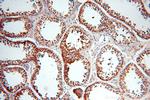 RDM1 Antibody in Immunohistochemistry (Paraffin) (IHC (P))