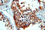 RDM1 Antibody in Immunohistochemistry (Paraffin) (IHC (P))
