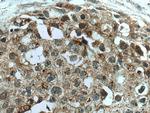 ZFHX3 Antibody in Immunohistochemistry (Paraffin) (IHC (P))