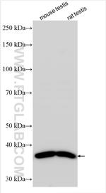 GLB1L3 Antibody in Western Blot (WB)