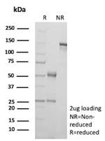 TIGIT/VSTM3/VSIG9 (Immune Checkpoint for Cancer) Monoclonal Antibody (TIGIT/3018)